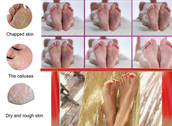 Get Newborn Baby Feet - Exfoliating Foot Masks x 2 Packs